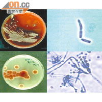 真菌較少有感染個案，感染者都以血癌、骨髓移植或愛滋病患者為主。