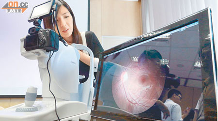 中大成功研發全自動視網膜血管分析系統，望可發展成簡單的篩查中風方法。（蘇文傑攝）