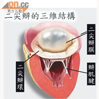 三維超聲波檢查有助及早診斷二尖瓣倒流，例如病情嚴重性，以便醫生決定治療方向。