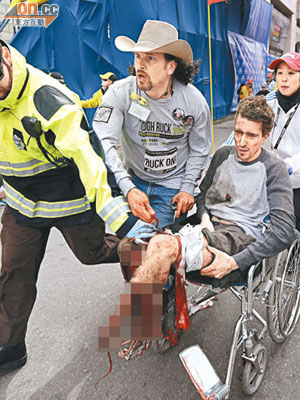 杰夫雙腳被炸至血肉模糊，被推離現場醫治。
