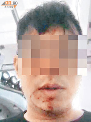 姓楊本港男子在雲南大理賓川縣雞足山旅遊時，無辜被打受傷。