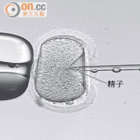 ICIS將一條精子直接注射入卵子協助受精。