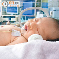 小麗抽搐近三天後被送往新生嬰兒深切治療部，並證實曾腦缺氧以致左腦大量細胞受損。