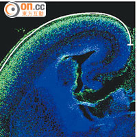右圖老鼠胚胎腦部被注入某類化學物後，大腦神經細胞（綠色位置）較一般老鼠（左圖）為多。