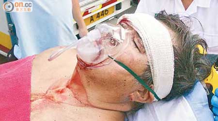 傷者送院時需戴上氧氣罩協助呼吸。（李少雄攝）