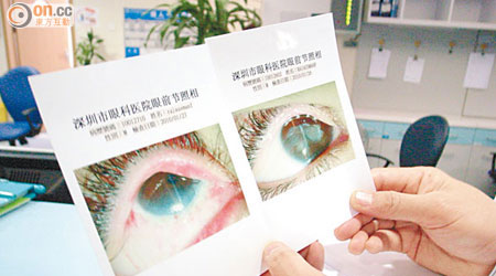 內地出售眼角膜有價有市，一片眼角膜動輒可售數萬至十多萬元不等。