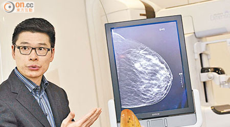 熊維嘉指亞洲女性乳腺密度較高，進行乳房X光造影時，較易出現假陰性。