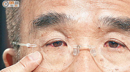 田二少懷疑自己患紅眼症，急急腳搵眼科醫生林順潮求診。（羅錦鴻攝）