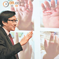 韓錦倫表示，若雙重感染病毒及細菌對病人殺傷更大。