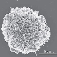 圖為被HIV病毒攻擊的白血球。（互聯網圖片）