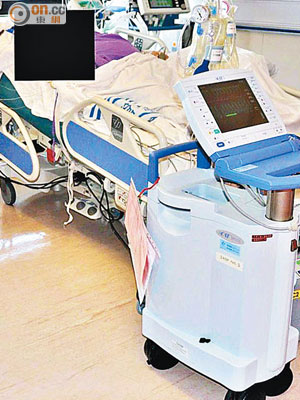 瑪嘉烈醫院女病人使用「主動脈內氣球幫浦」期間，儀器顯示屏失靈。（資料圖片）