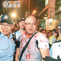 有佔中示威者被圍毆到頭破血流，要由警員護送離開。（馮戈攝）