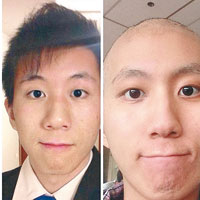 俊培曾在網上公開抗病時「剃光頭」與治療前的自拍照勉勵大家。（互聯網圖片）