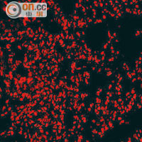顯微鏡下出現廣泛紅色範圍，接受治療後，只有小量病毒抗原。