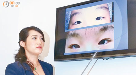 楊珍珍稱，眼瞼贅皮常見於亞洲兒童，每十人有一人出現此情況。（曾愷欣攝）