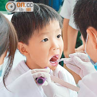 醫生建議每年定期檢查一次牙齒。