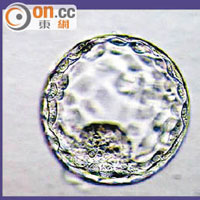 顯微鏡下，質素較佳的胚胎（左）與質素較差的胚胎（右）。