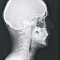 正常頸椎（圖）與變形頸椎有很大對比。（互聯網圖片）