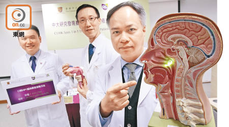 （左起）黃至生、林偉雄及陳基湘公布研究結果，發現本港每五名口咽癌患者，一人感染HPV導致。（胡家豪攝）