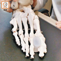 矯形器設計簡單，夾在拇趾及二趾之間減少摩擦。