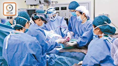 換肝團隊兩日「直踩」做手術，將四個肝移植給四名垂危病人。（資料圖片）