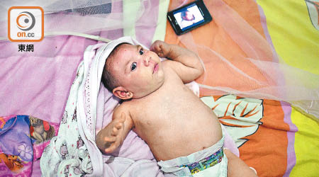 感染寨卡病毒的孕婦有機會誕下小頭症嬰兒。（資料圖片）