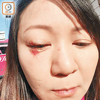 車上有女乘客的臉部受傷。