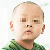 南京有未滿兩歲的男童疑因甲醛中毒，確診白血病。（互聯網圖片）