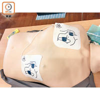 使用心臟去顫器時，須注意將電極片按指示緊貼病者胸膛。