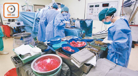 腦硬膜下積血的病人或需要做顱骨鑽孔手術清除積血。（資料圖片）