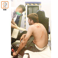 尖沙咀<br>傷者在救護車上接受包紮。