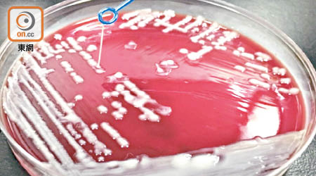 新型的超級惡菌具有厚黏液狀外層。（受訪者提供）