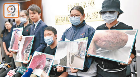 鄭先生（右三）與其他傷者家屬出席記者會，申訴意外後未獲賠償。