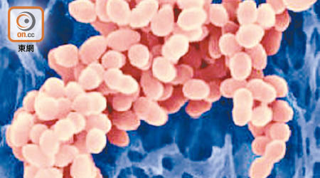 耐藥性金黃葡萄球菌具侵略性，可攻擊健康組織。（資料圖片）