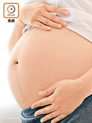 研究指剖腹產的嬰兒長大肥胖風險較高。（資料圖片）