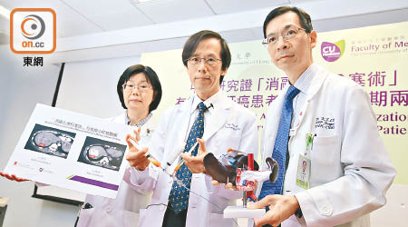 余俊豪（中）表示，新技術大幅提升抗癌藥濃度。左為中大醫學院腫瘤學系教授楊明明，右為外科學系名譽臨床副教授李傑輝。（胡家豪攝）