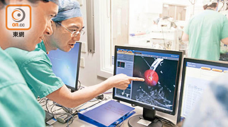 劉家榮醫生（左二）在醫院內，領導人員處理免開刀無創微波消融肺腫瘤手術。（聖巴多羅買醫院提供）