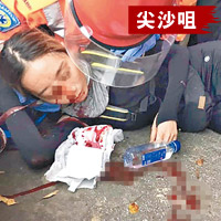 一名女示威者混亂中眼部受傷。（互聯網圖片）