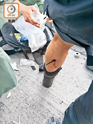 警方傳媒聯絡隊警員被暴徒用箭射傷腳部，活動能力恐受損。