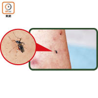 有市民於崇山新村內逗留十分鐘，已被蚊蟲連叮五口，其中一隻疑是白紋伊蚊。