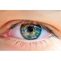 當視網膜色素出現病變，便有機會造成夜盲症。