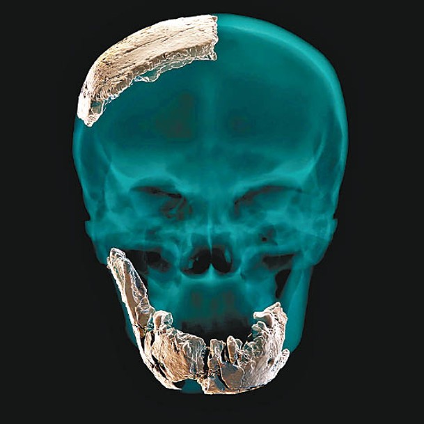 電腦模擬重組頭骨。