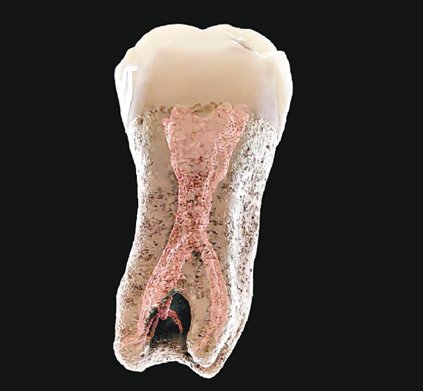 下顎化石帶有臼齒。