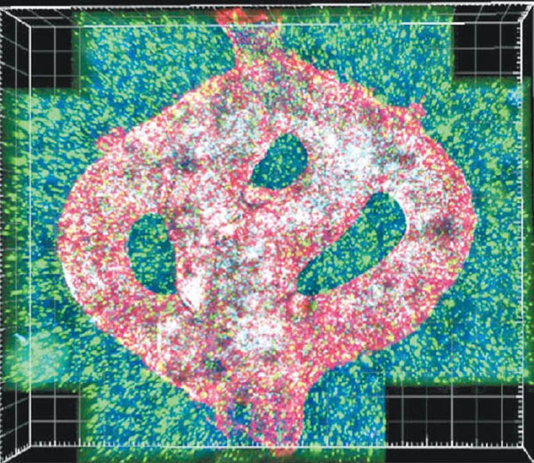 膠質母細胞瘤組織模型在顯微鏡下的畫面。