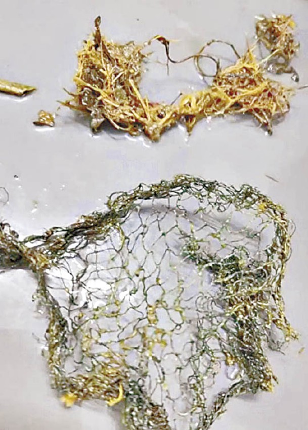海龜腸道有魚網等海洋垃圾。