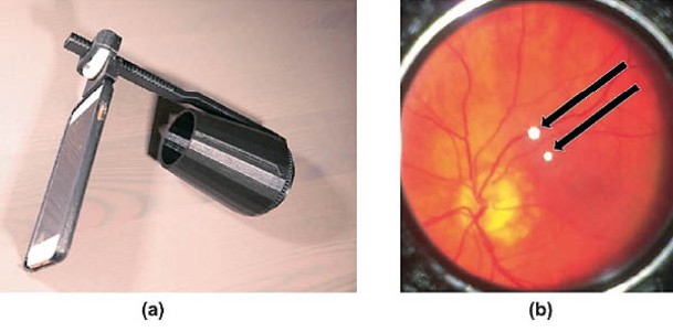 儀器可用於檢測視網膜脫離。