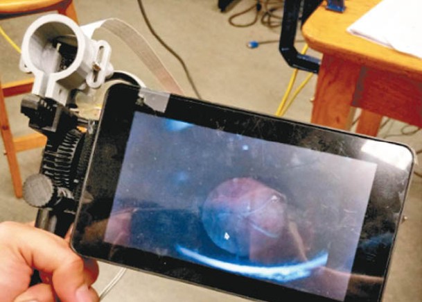 儀器原型可連接手機拍攝眼睛影像。