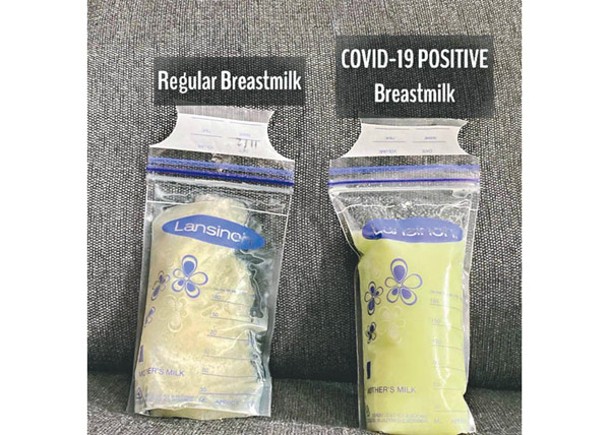 女子正常母乳（左）與染疫之後母乳（右）顏色不同。