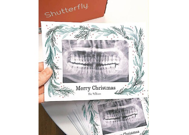 誤製牙齒X光聖誕卡  網民蜂擁讚好