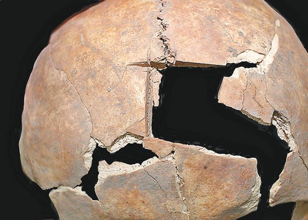 頭骨現方形洞  揭3500年前已開腦
